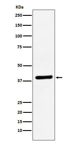 Anti-VEGFD Rabbit Monoclonal Antibody