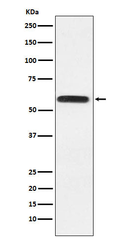 Anti-LGI1 Rabbit Monoclonal Antibody