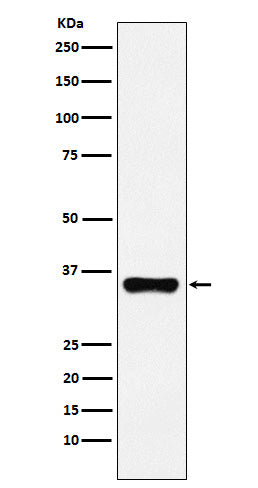 Anti-HOXA9 Rabbit Monoclonal Antibody