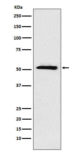 Anti-ETV6 Rabbit Monoclonal Antibody