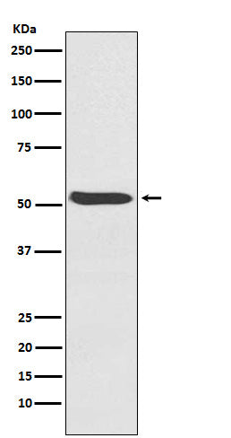 Anti-ACVR1 Rabbit Monoclonal Antibody