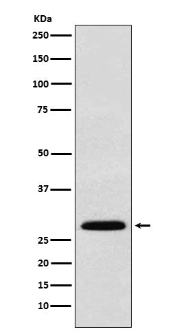 Anti-KGF Rabbit Monoclonal Antibody