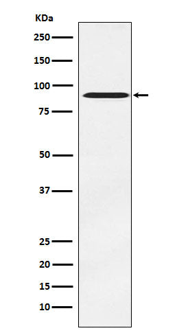 Anti-ATRIP Rabbit Monoclonal Antibody