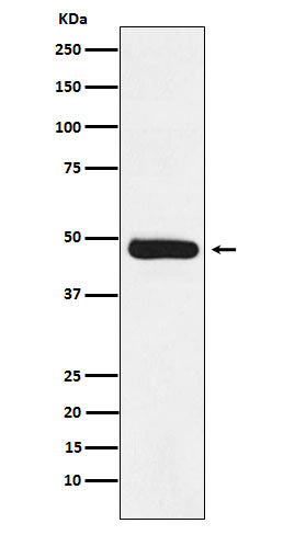 Anti-ERCC8  Rabbit Monoclonal Antibody
