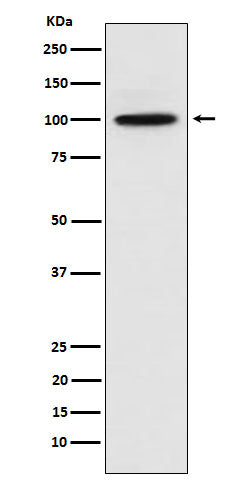 Anti-CTNNA3 Rabbit Monoclonal Antibody