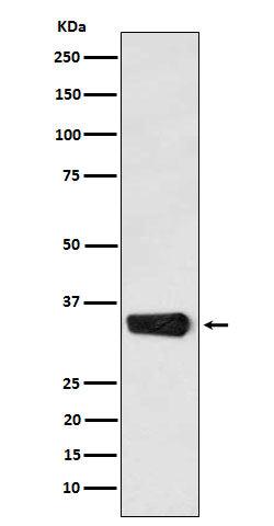 Anti-MBD3 Rabbit Monoclonal Antibody