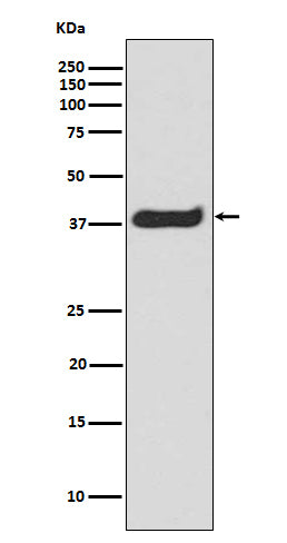 Anti-Phospho-LAT (Tyr191) Rabbit Monoclonal Antibody