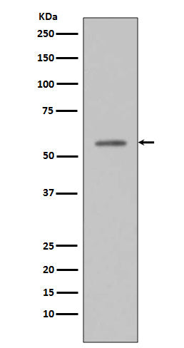 Anti-Phospho-p53 (Ser33) Rabbit Monoclonal Antibody