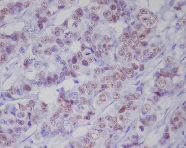 Anti-Phospho-p53 (Ser392) Rabbit Monoclonal Antibody