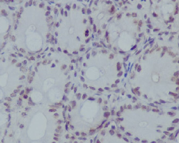 Anti-MonoMethyl-Histone H3 (Arg17) Rabbit Monoclonal Antibody