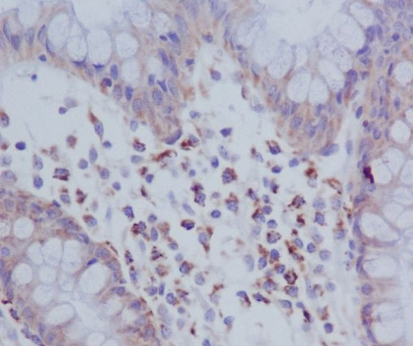 Anti-Phospho-PKR (Thr446) Rabbit Monoclonal Antibody