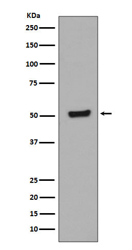 Anti-Phospho-p53 (Thr55) Rabbit Monoclonal Antibody