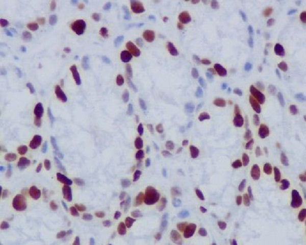 Anti-Phospho-Histone H1.4 (Thr17) Rabbit Monoclonal Antibody