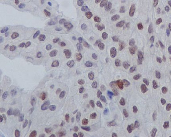 Anti-Phospho-GATA3 (Ser308) Rabbit Monoclonal Antibody