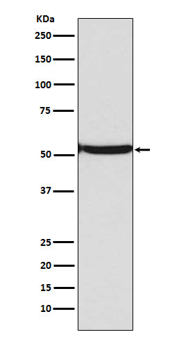 Anti-Acetyl-p53 (Lys382) Rabbit Monoclonal Antibody