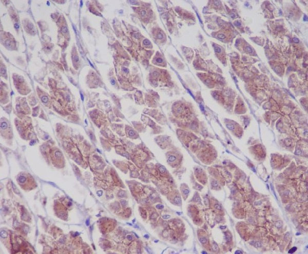 Anti-Phospho-EGFR (Tyr1173) Rabbit Monoclonal Antibody