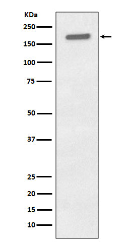 Anti-Phospho-EGFR (Tyr1173) Rabbit Monoclonal Antibody