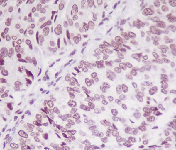 Anti-Phospho-SMC1A (Ser957) Rabbit Monoclonal Antibody