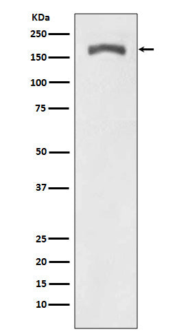 Anti-Phospho-PDGFR beta (Tyr740) Rabbit Monoclonal Antibody