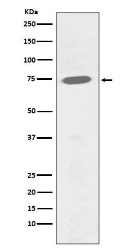 Anti-Phospho-BTK (Tyr551) Rabbit Monoclonal Antibody