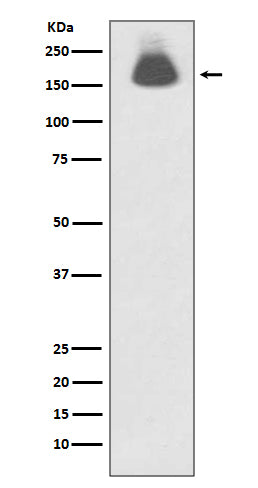 Anti-Phospho-EGFR (Ser695) Rabbit Monoclonal Antibody