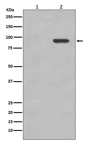 Anti-Phospho-beta Catenin (Ser33/Ser37) Rabbit Monoclonal Antibody