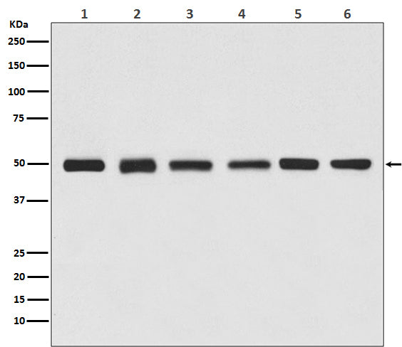Anti-beta III Tubulin Rabbit Monoclonal Antibody (HRP)
