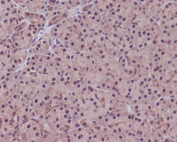 Anti-PP1C alpha/beta Rabbit Monoclonal Antibody