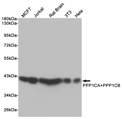 Anti-PP1C alpha/beta Rabbit Monoclonal Antibody