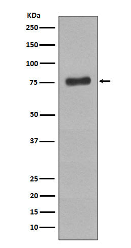 Anti-Phospho-BTK (Tyr223) Rabbit Monoclonal Antibody