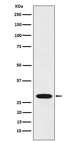 Anti-Pirh2 Rabbit Monoclonal Antibody