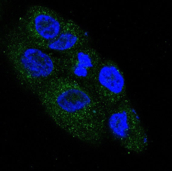Anti-NGF Rabbit Monoclonal Antibody