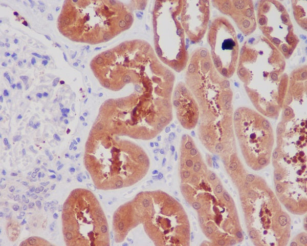 Anti-NGF Rabbit Monoclonal Antibody