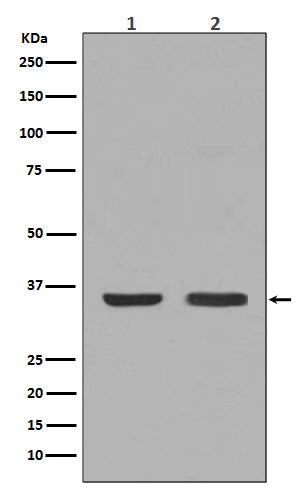 Anti-NGF Rabbit Monoclonal Antibody