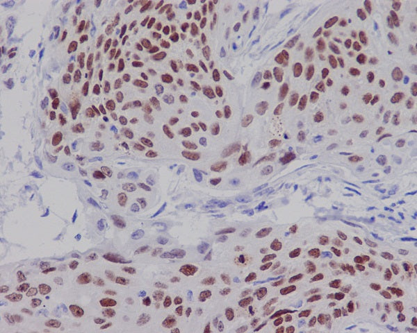 Anti-SOX2 Rabbit Monoclonal Antibody