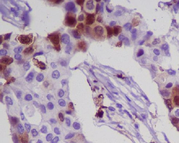 Anti-S100A8 Rabbit Monoclonal Antibody