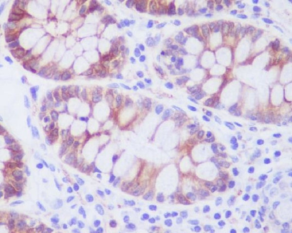 Anti-Stathmin 1 Rabbit Monoclonal Antibody