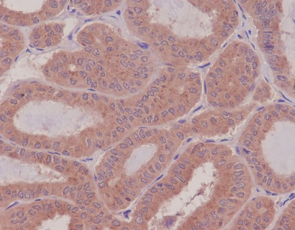 Anti-RHOA Rabbit Monoclonal Antibody