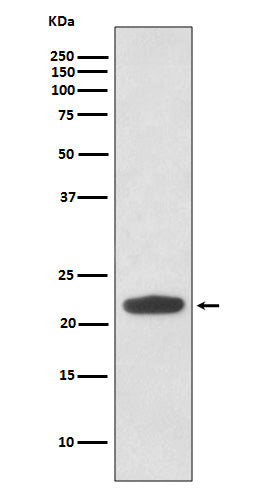 Anti-RHOA Rabbit Monoclonal Antibody