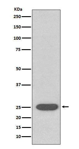 Anti-SOD2 Rabbit Monoclonal Antibody