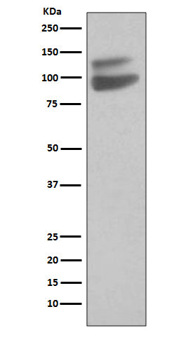 Anti-VE Cadherin Rabbit Monoclonal Antibody
