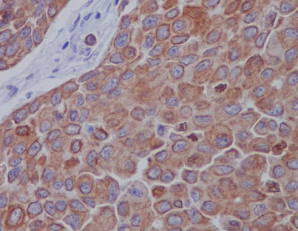 Anti-Mitofusin 2 Rabbit Monoclonal Antibody
