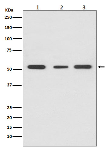 Anti-PPAR gamma Rabbit Monoclonal Antibody