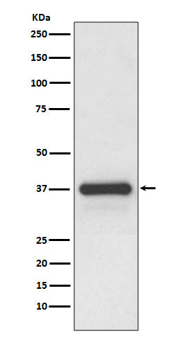 Anti-Podoplanin Rabbit Monoclonal Antibody