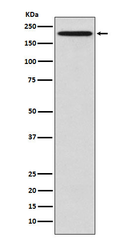 Anti-GCN2 Rabbit Monoclonal Antibody