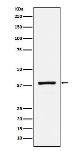 Anti-RASSF1 Rabbit Monoclonal Antibody