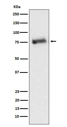 Anti-GRK3 Rabbit Monoclonal Antibody