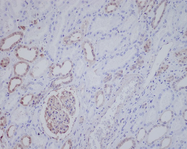 Anti-ALK Rabbit Monoclonal Antibody