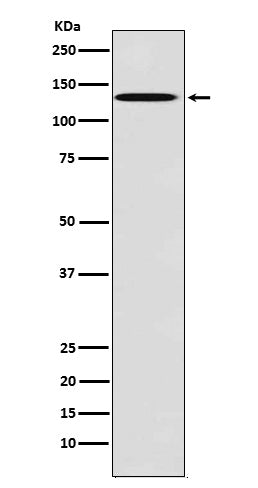 Anti-TYRO3 Rabbit Monoclonal Antibody