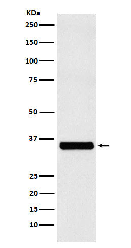 Anti-RRP42 Rabbit Monoclonal Antibody